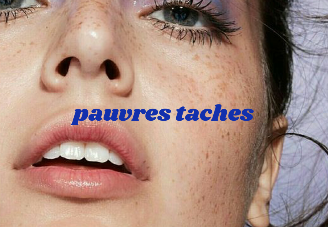 Comment On Dit Roux En Anglais Adindaaa: Tache De Rousseur En Anglais