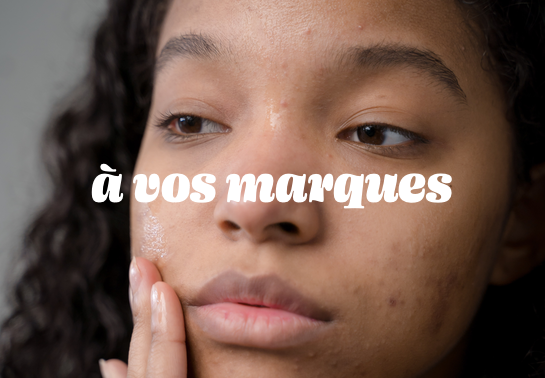 Venir à bout des marques d'acné